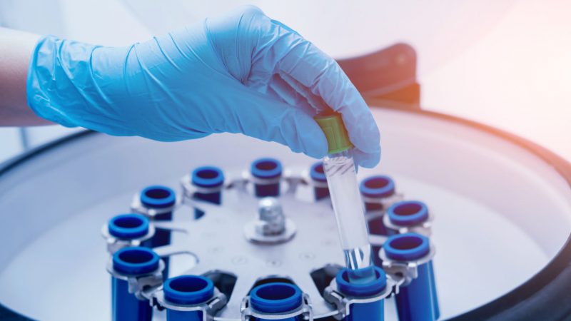 无标签定量蛋白质组学