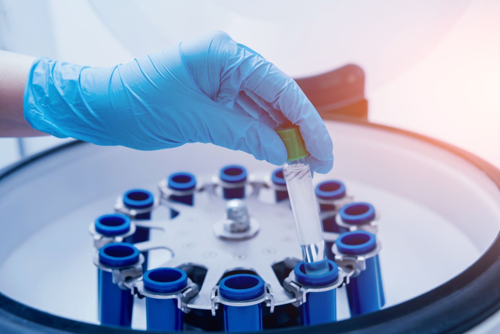 无标记定量蛋白质组学