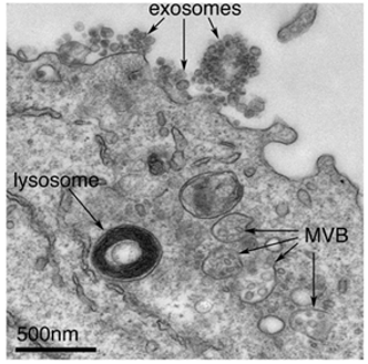 外泌体对应于多囊体的腔内小泡
